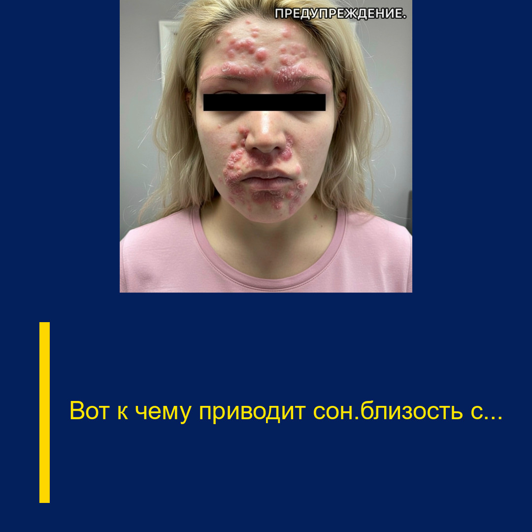 Вот к чему приводит сон/близость с…