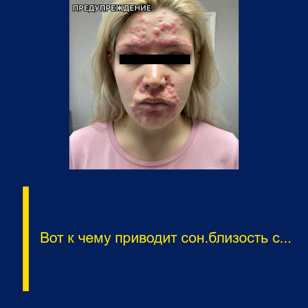 Вот к чему приводит сон/близость с…