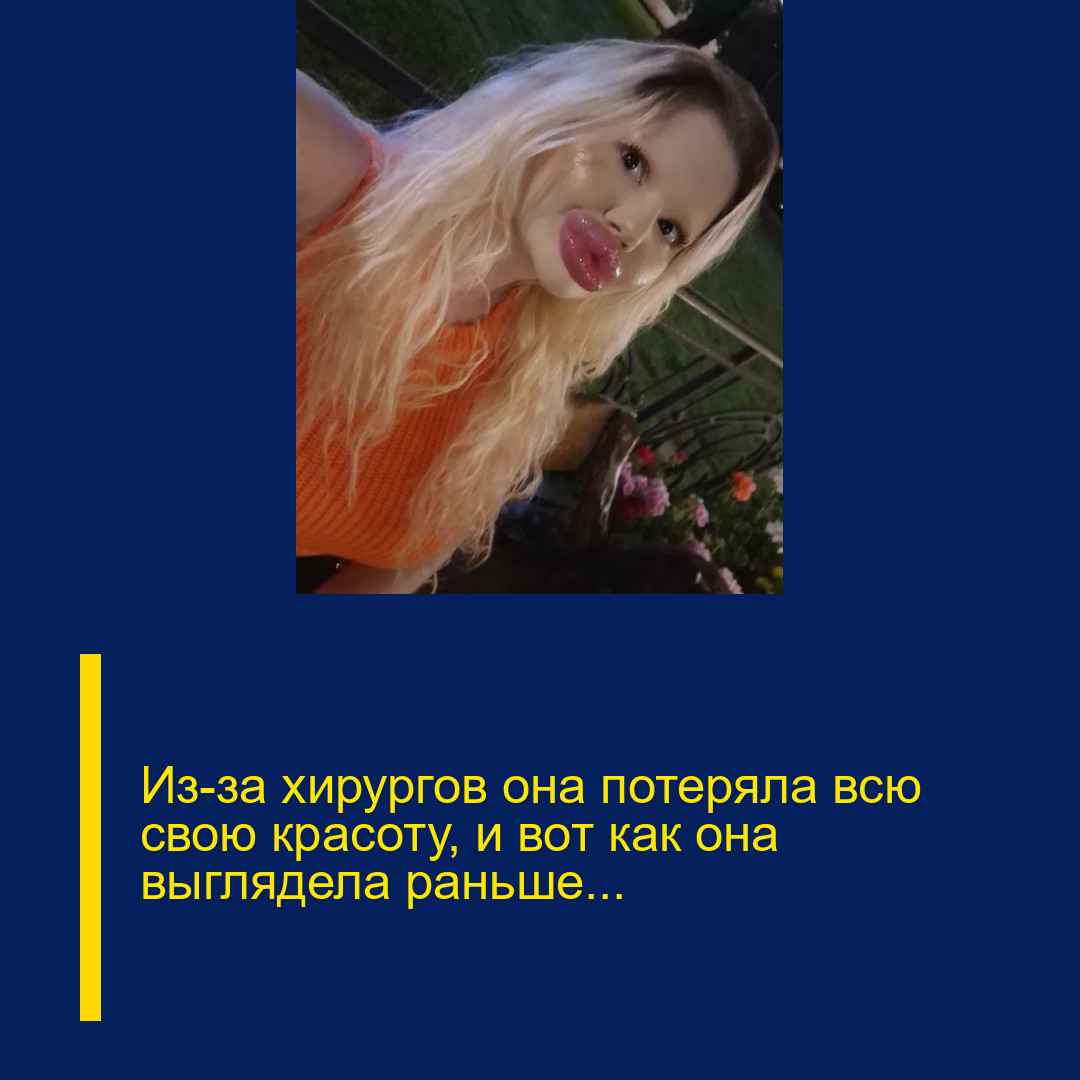 Из-за хирургов она потеряла всю свою красоту, и вот как она выглядела раньше…