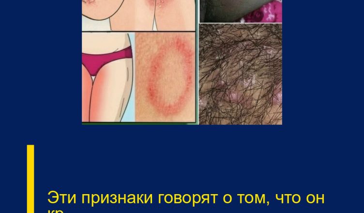 Эти признаки говорят о том, что он кр…