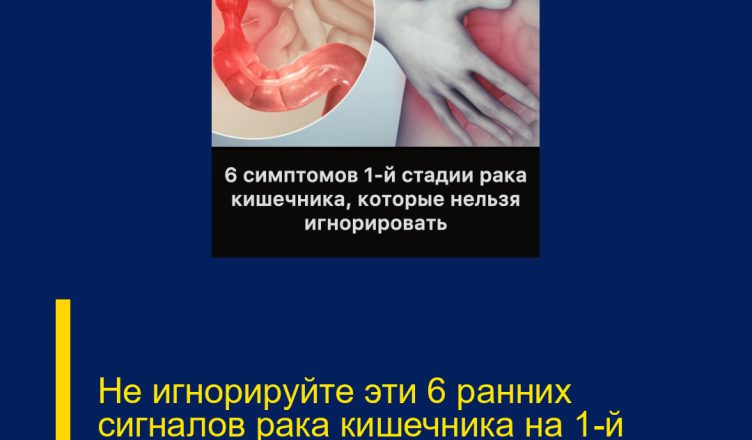 Не игнорируйте эти 6 ранних сигналов рака кишечника на 1-й стадии