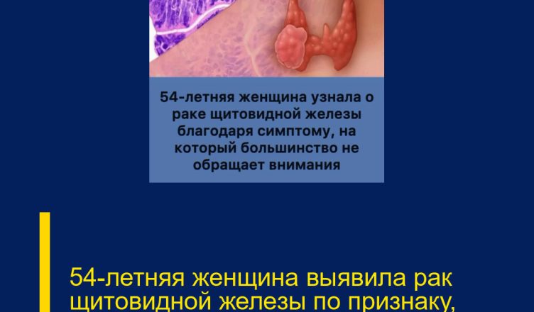 54-летняя женщина выявила рак щитовидной железы по признаку, который часто остаётся без внимания