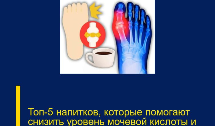 Топ-5 напитков, которые помогают снизить уровень мочевой кислоты и облегчить подагру.